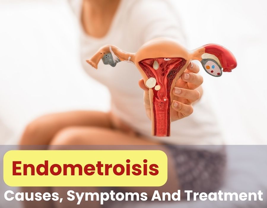 Understanding Endometriosis- Causes, Symptoms And Treatment - femcare