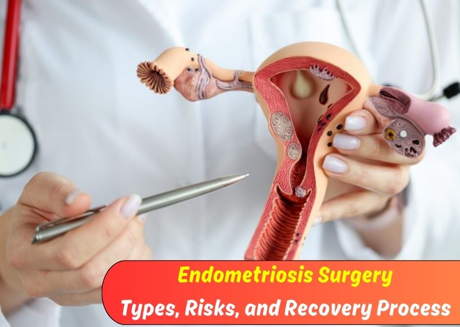 Endometriosis Surgery Types, Risks, and Recovery Process