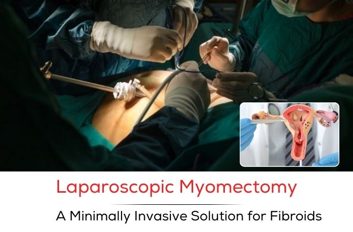 Laparoscopic Myomectomy