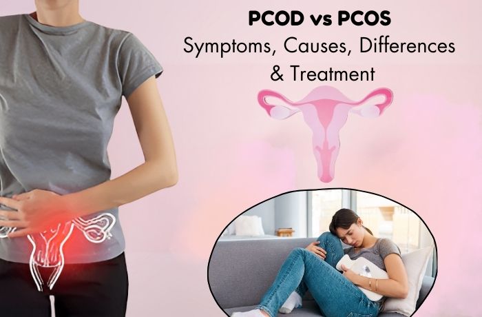 PCOD vs PCOS - Symptoms, Causes, Differences & Treatment